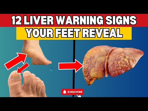 12 Ways Your Feet Are Warning you About Your Liver!