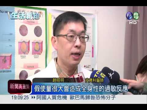 連吃一個月香菇...女子過敏皮膚炎