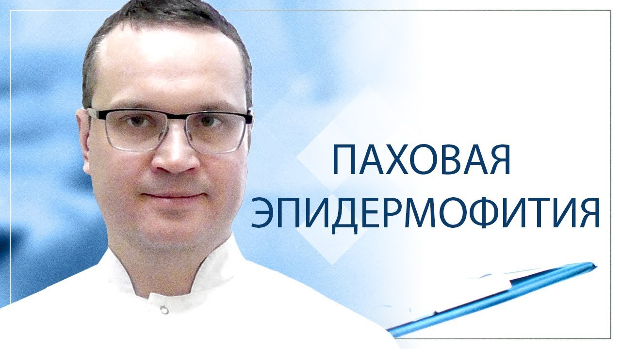 Паховая эпидермофития