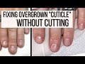 How to FIX Overgrown Cuticles WITHOUT CUTTING.