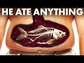 What Happened To The Man Who Ate Everything He Saw