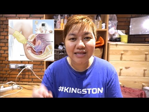 ข่าวในการรักษาโรคสะเก็ดเงิน สำหรับแพทย์โรคสะเก็ดเงิน