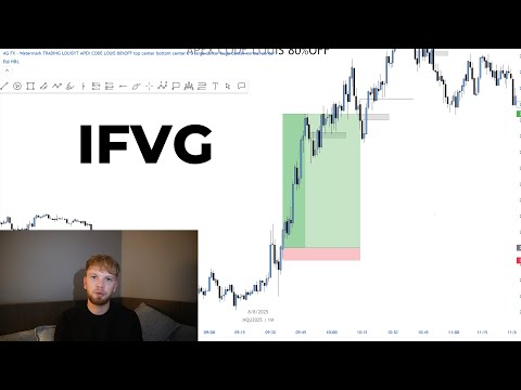 16,153$ Winning trade full top down analysis(80% Winrate strategy exposed)