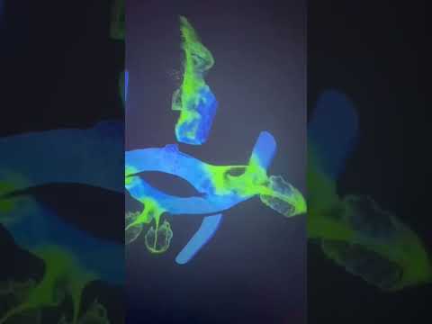Laser Projection Mapping Video
