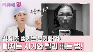 성형 후 생기는 붓기와 멍은 언제 빠지나요? (Feat.빨리빼는법)! | 와이영성형외과