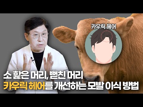 소가 핥은 앞머리 카우릭 헤어... 모발 이식으로 방향을 바꿀 수 있을까?