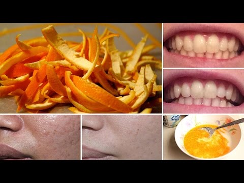 Hypertonie bei älteren Menschen Ernährung bei Bluthochdruck und Typ-2-Diabetes
