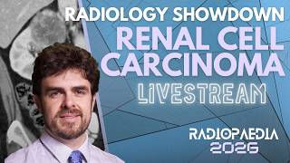 Radiology Showdown: Renal Cell Carcinoma with Matt Morgan