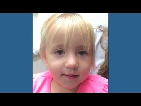 What is craniosynostosis?