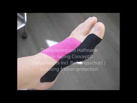 Podo-Taping-Concept© - Hallux valgus Tape mit Reibungs- und Druckschutz
