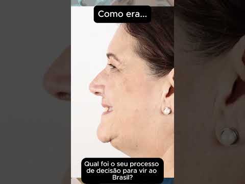 Patient Travels From the United States for Dental Implants in Blumenau, Brazil by  Dr. Fernando Giovanella