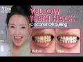 Do This for 7 Days: Ancient Oil Pulling Ritual for Whiter Teeth & Fresh Breath