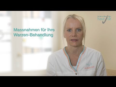 Was ist bei einer Warzenbehandlung mit dem Laser zu beachten?