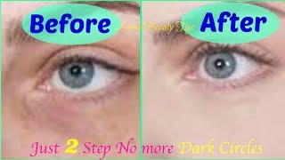 Follow these 2 steps to get rid of Dark Circles & Puffy Eyes🌿  |  Lovely Beauty Tips |