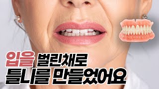 씹을 수 없던 임플란트 틀니 해결한 방법, 직접 보여드립니다 | 35년차 치과의사가 알려드립니다