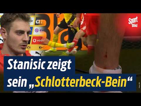 Rot für den BVB? Schlotterbeck, Stanisic, Kompany & Kovac zum Spiel