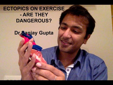 Ectopics on exercise - Are they dangerous?