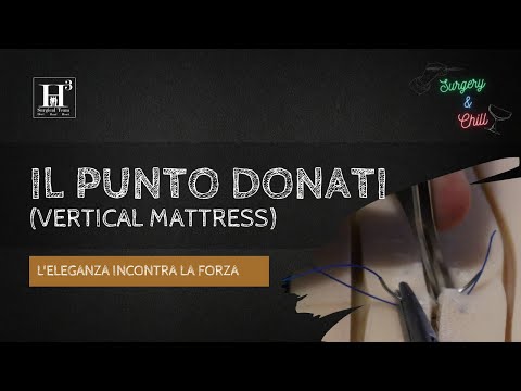 L'eleganza incontra la forza: Il punto Donati | Surgery&Chill