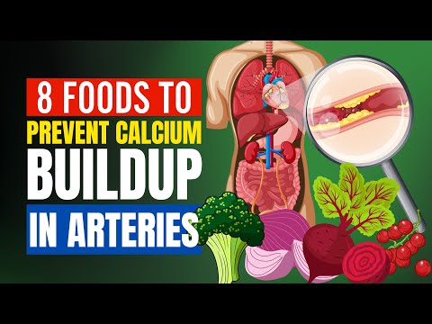 , title : 'Foods To Prevent Calcium Buildup In Arteries (DO NOT IGNORE)'