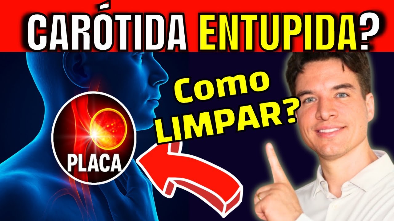 CLOGGED CAROTID ARTERY? 7 MUST-TAKE steps to REDUCE the risk of STROKE by 80% and clear plaque!