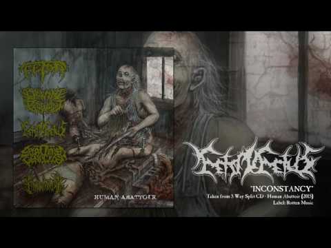 FETO IN FETUS - Inconstancy