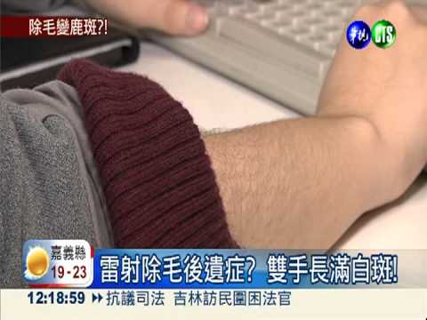 雷射除毛長白斑 粉領族變梅花鹿!