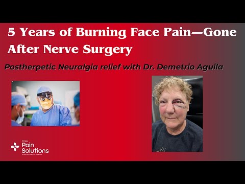 Postherpetic Neuralgia of the Face: Patricia's Journey
