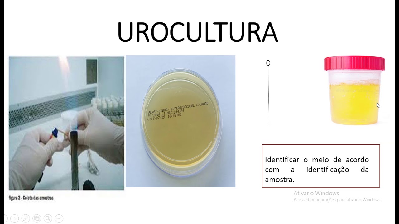 UROCULTURA