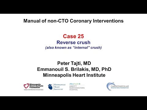 Case 25: PCI Manual: Reverse Crush