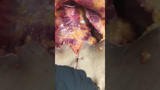 Second opinion autopsy with missing organs