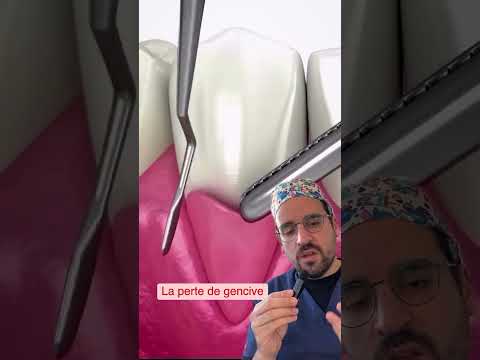 Dental GUM LOSS, why does it recede?