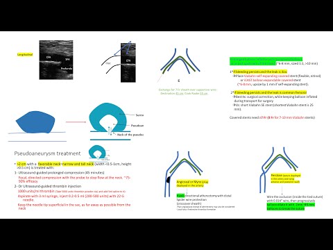 Access complications and management