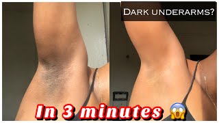 How to Get rid of Dark underarms in 3 minutes (instant result)
