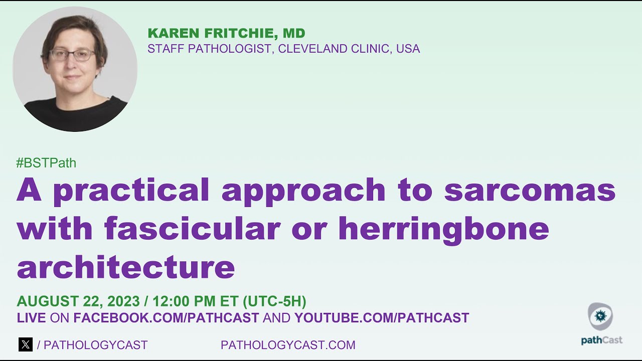 #BSTPATH  Practical Approach  to Sarcomas with Fascicular or Herringbone Architecture