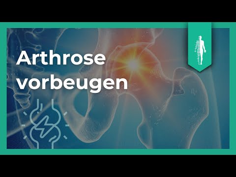 Arthrose: DAS solltest Du über Deine Gelenke wissen! Dr. Jens Freese