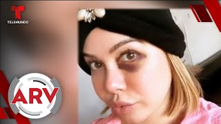 Famosos ARV: Chiquis Rivera rompe el silencio sobre moretón, comienza La Voz y más | Telemundo Famosos ARV: Chiquis Rivera rompe el silencio sobre moretón, comienza La Voz y más | Telemundo