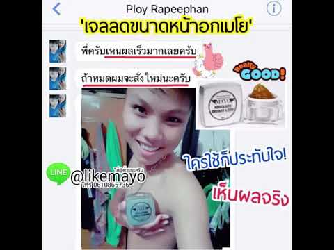 Papilomki เล็ก ๆ บนหน้าอก ลูกเล็ก ๆ เกี่ยวกับหน้าอก