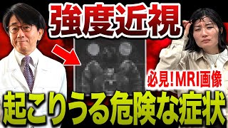 MRI画像で納得！近視が強いとどんな病気の危険性があるのか眼科医が詳しく解説します！