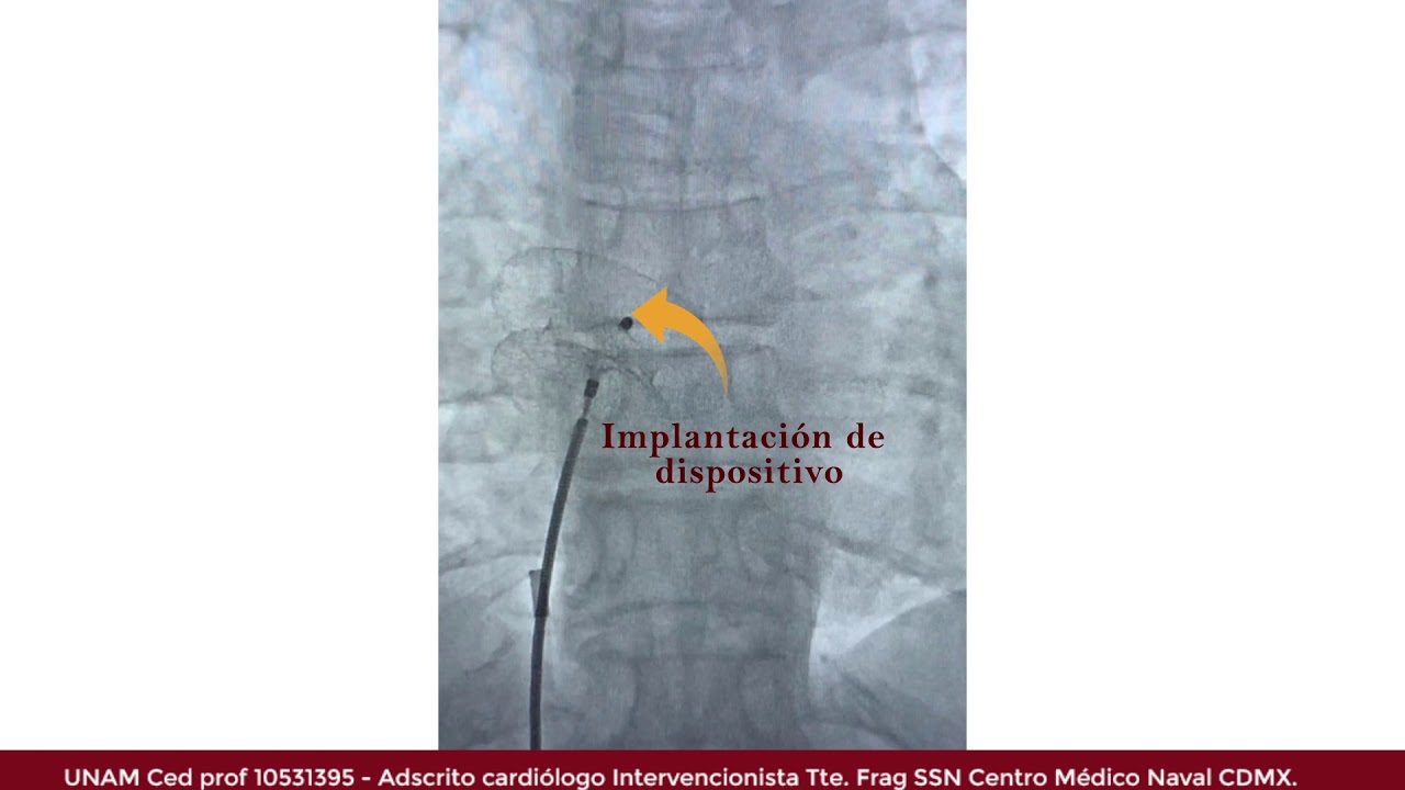Marcelo Utrera Lagunas-110