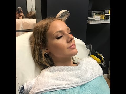 Is Princess Filler Good for Lips? Kimberley Discusses her treatment.