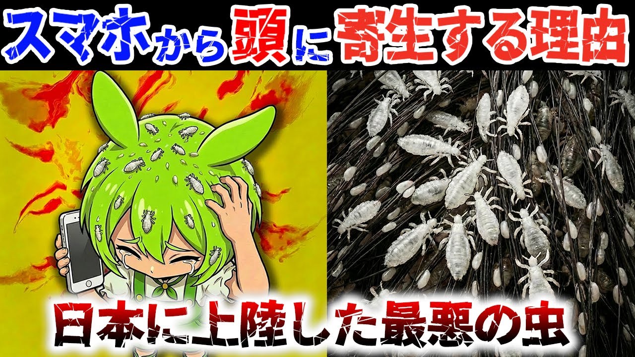 【猶予無し】2026年 日本で急増!? 頭に寄生する「進化したシラミ」頭皮を食い荒らす【ずんだもん解説】