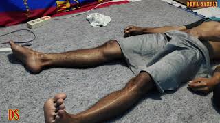 Download lagu #pijat tradisional #pijat untuk perut  biasa mp3