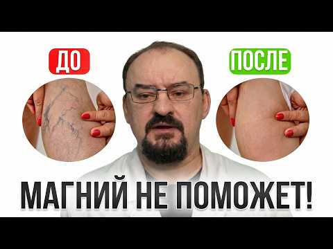 Вас лечат неправильно! Настоящая причина судорог и застоя крови
