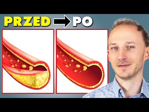 Jak odmłodzić i oczyścić tętnice: 14 sposobów, jak dbać o tętnice i krążenie | Dr Bartek Kulczyński