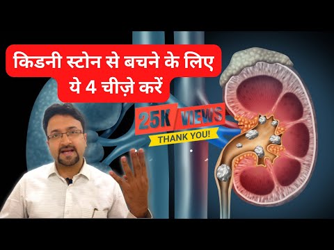 Kidney Stone Prevention Diet & Tips