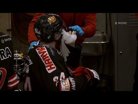 Jan Scotka sai verisesti mailasta kasvoihin