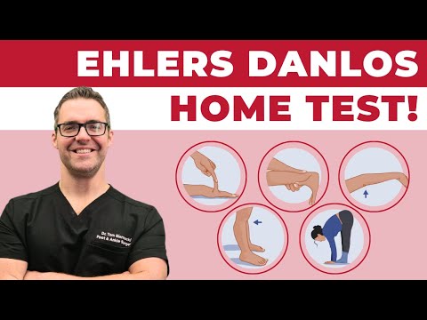 Ehlers Danlos Syndrome Test AT Home [Beighton Test Diagnosis]