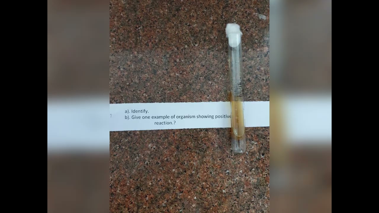 Microbiology spotters for MBBS exams