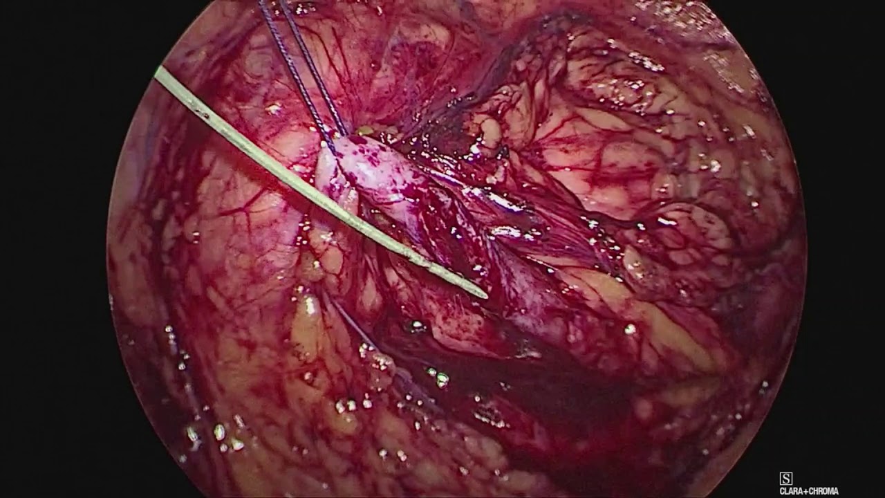 Humberto Romo Valdes-34