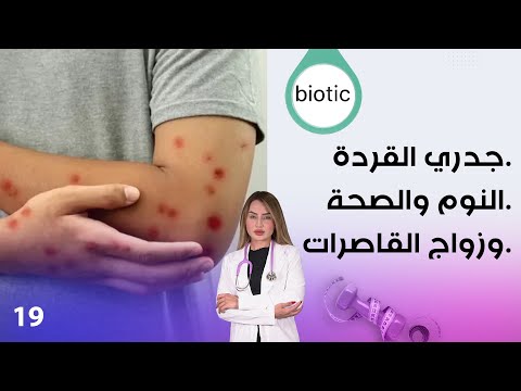 شاهد بالفيديو.. جدري القردة _النوم والصحة _وزواج القاصرات - م٣ Biotic - الحلقة ١٩